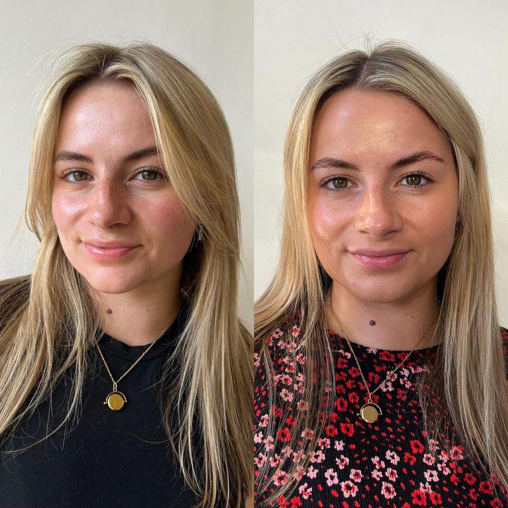 Skinny Tan Notox Drops UGC before and after results image