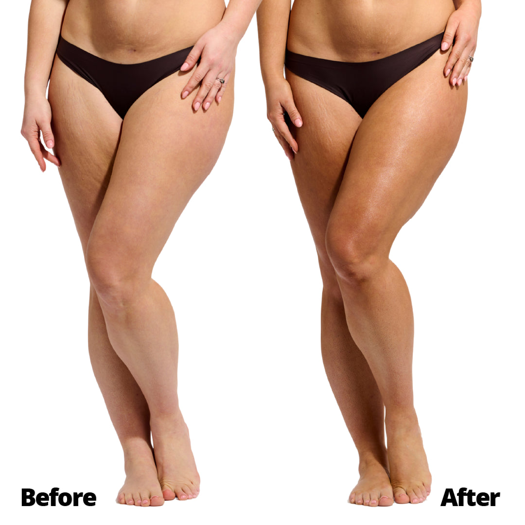 Self-Tanning Mousse Medium Model Before and After leg results