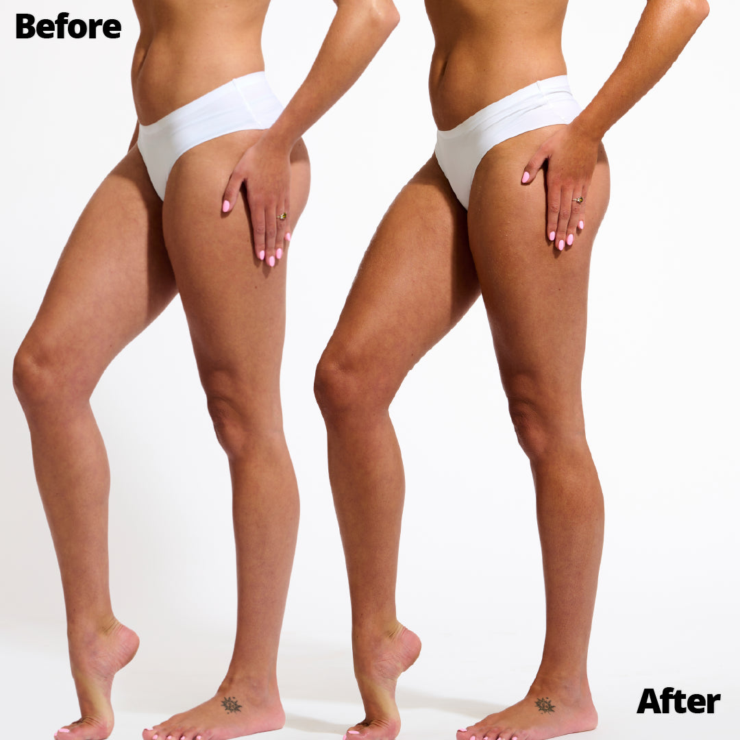 Wonder Serum Model before and after leg results