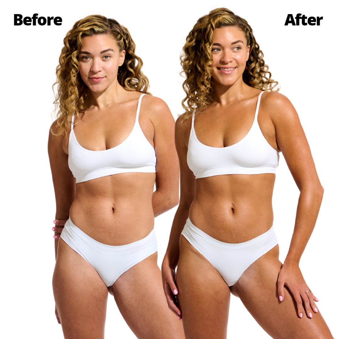 Wonder Serum Model before and after results
