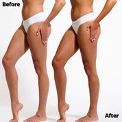 Wonder Serum Model before and after leg results