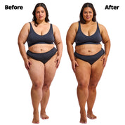 Wonder Serum Model before and after results